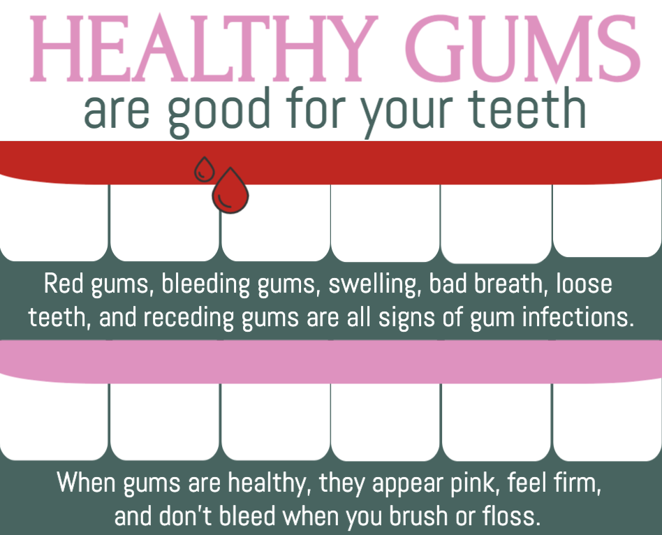 Healthy Gums Are Good for Your Teeth | Brian McDowell DDS